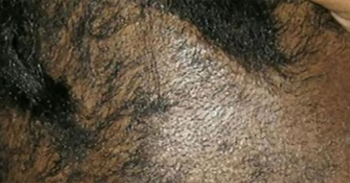 detoxing scalp